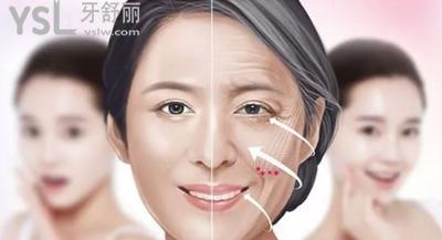 廣州聶云飛醫(yī)生做拉皮手術(shù)怎么樣？網(wǎng)友口碑實測！