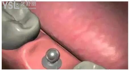 安裝基臺