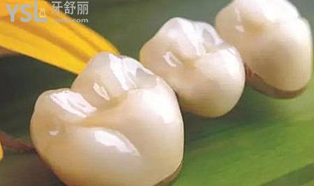 我是該補(bǔ)牙還是做烤瓷牙哪一個(gè)好？