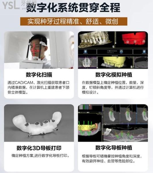 廣州德倫口腔數(shù)字化種植系統(tǒng)