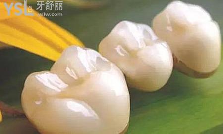 全瓷牙可以洗牙嗎？