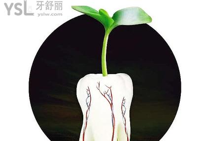 種植牙靠譜嗎