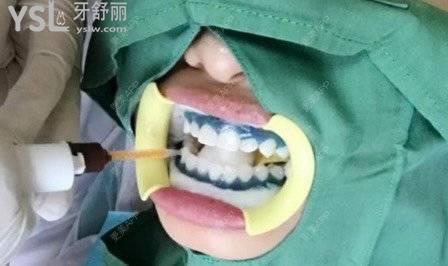 承德玥萊美口腔科怎么樣