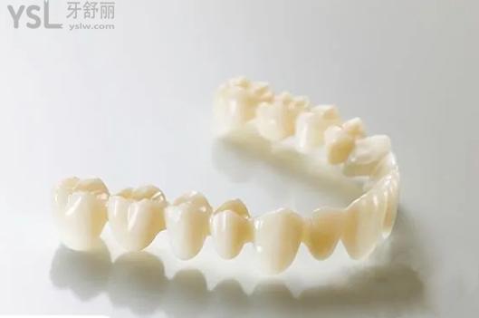 全瓷牙和烤瓷牙區(qū)別有哪些？
