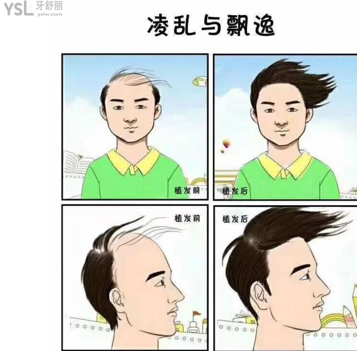 海口植發(fā)好的醫(yī)院有哪些