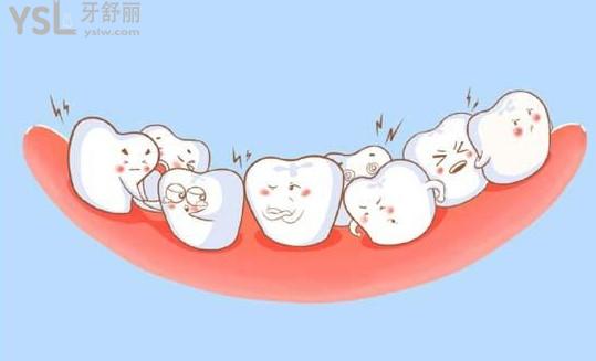 替牙期比較重的牙齒擁擠