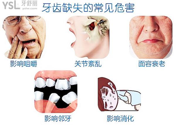 全口無牙怎么種植牙，來看答案