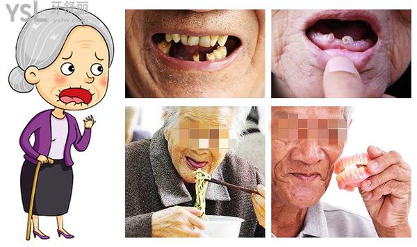 八十歲的老人還能種牙嗎？老人種牙需要什么條件？展開說說