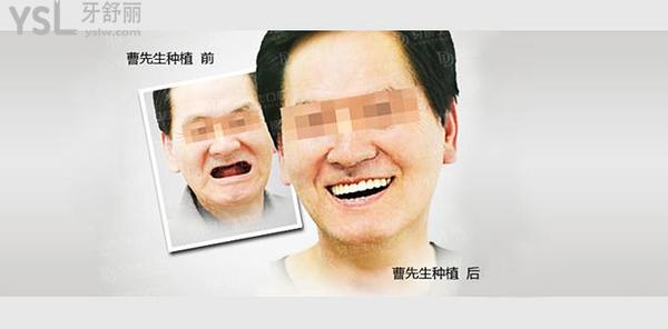八十歲的老人還能種牙嗎？老人種牙需要什么條件？