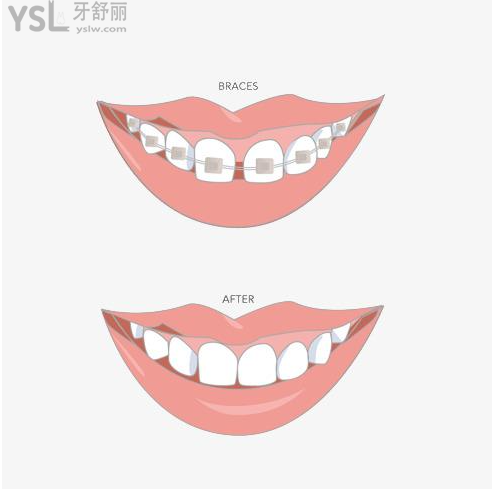 深圳牙科醫(yī)院哪家好的醫(yī)院價格還便宜