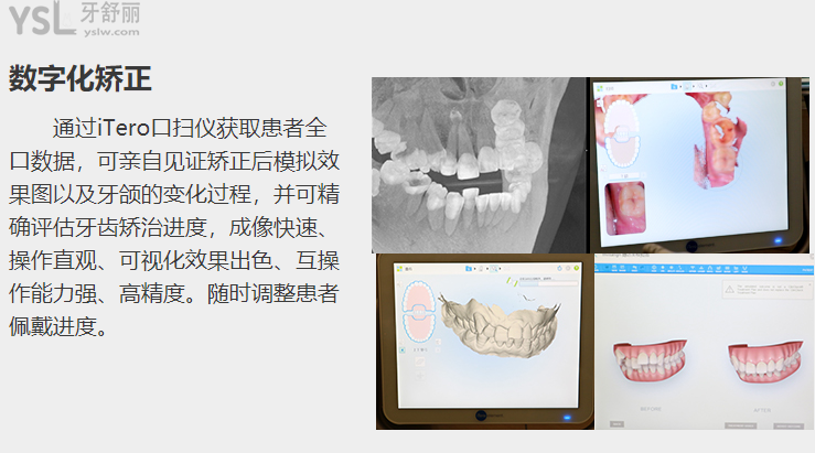 深圳牙科醫(yī)院哪家好的醫(yī)院價格還便宜