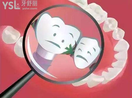種植牙后可以吃東西嗎？來看種植牙后注意事項有哪些
