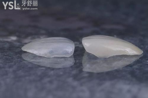 烤瓷牙