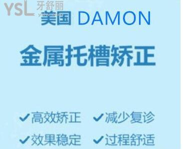 damonq自鎖托槽價(jià)位
