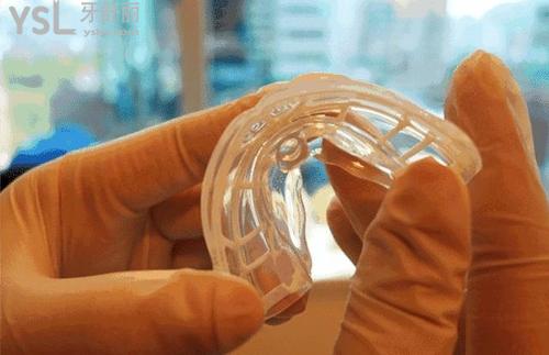 兒童mrc矯正器適合的年齡和成效情況怎么樣？牙醫(yī)揭開(kāi)謎團(tuán)