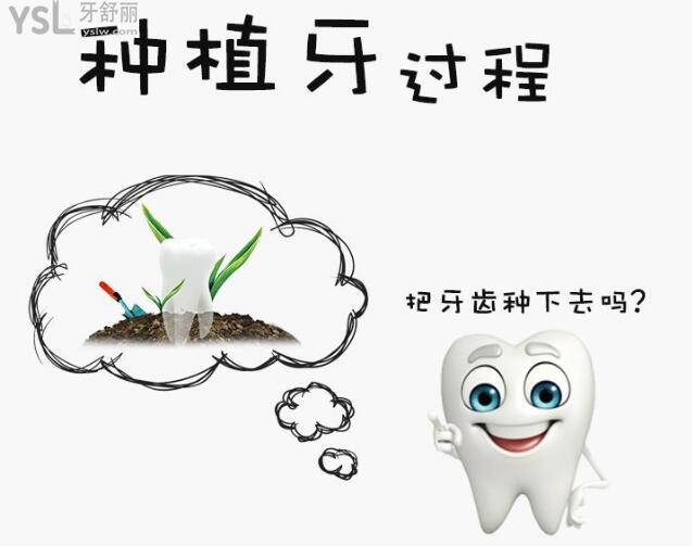 zimmer種植體價(jià)格高，它值那個(gè)價(jià)嗎？.jpg
