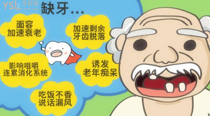 連續(xù)缺失三顆牙齒要怎么辦