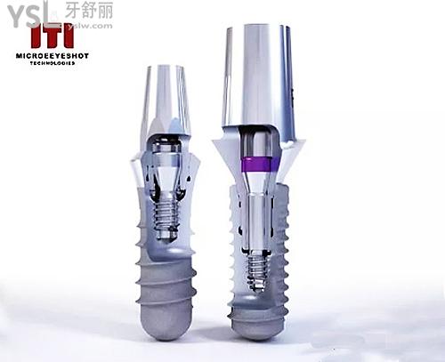 瑞士blt種植體和iti有區(qū)別嗎？主要看這幾個方面！