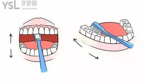 錯(cuò)誤刷牙方法導(dǎo)致牙縫大