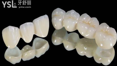 帶牙冠的過程痛苦嗎
