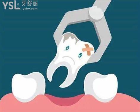 拔牙卡通圖