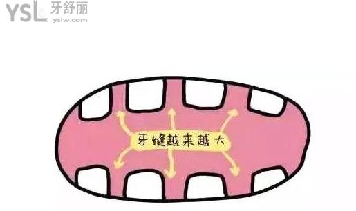 牙縫大怎么辦？
