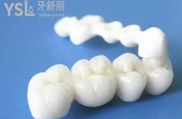 全瓷冠屬于假牙嗎