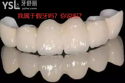 全瓷冠屬于假牙嗎
