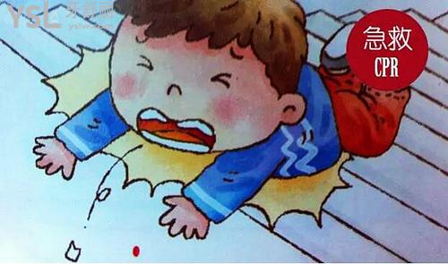 小孩牙齒外傷松動(dòng)多久能長(zhǎng)好？小孩牙齒受傷松動(dòng)疼痛怎么辦？