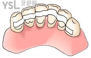 小孩牙齒受傷松動(dòng)疼痛怎么辦？