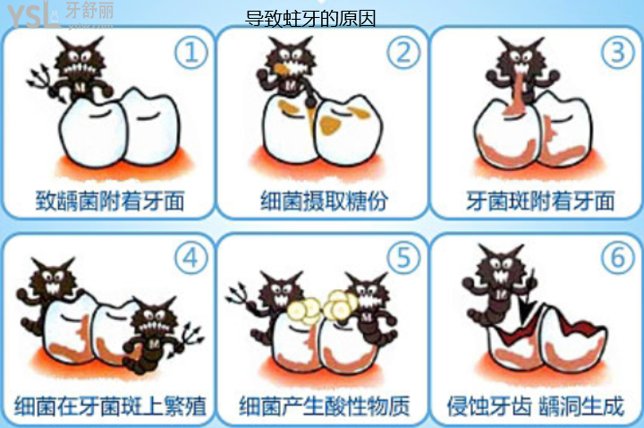 牙齒發(fā)黑怎么是什么原因