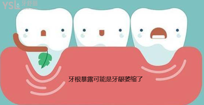 老年人牙齒掉了一部分原因