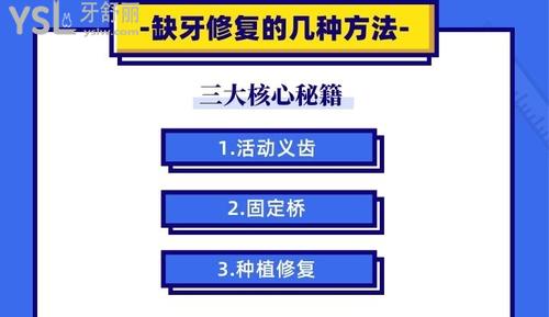 缺一顆牙齒怎么補好？