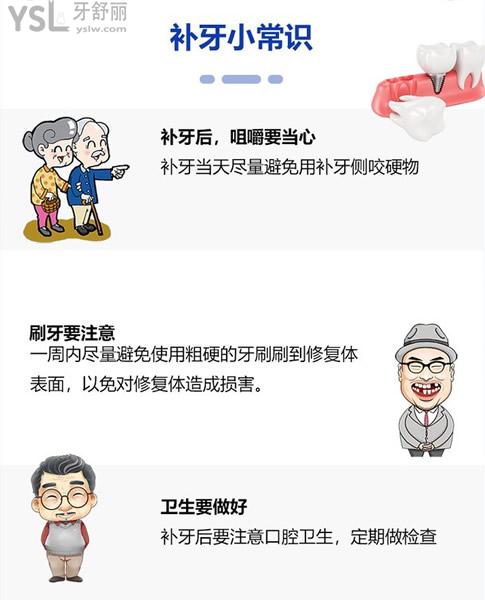 補(bǔ)牙小常識必知