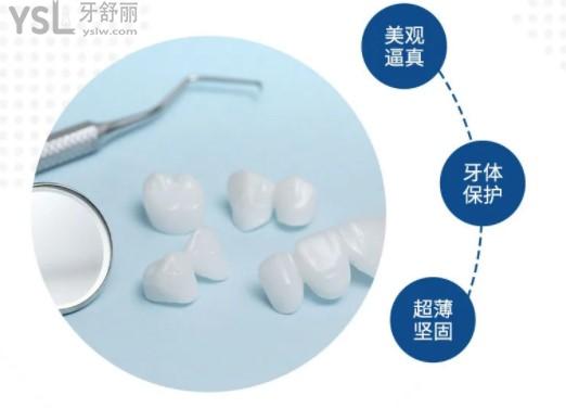 全瓷牙貼面優(yōu)點