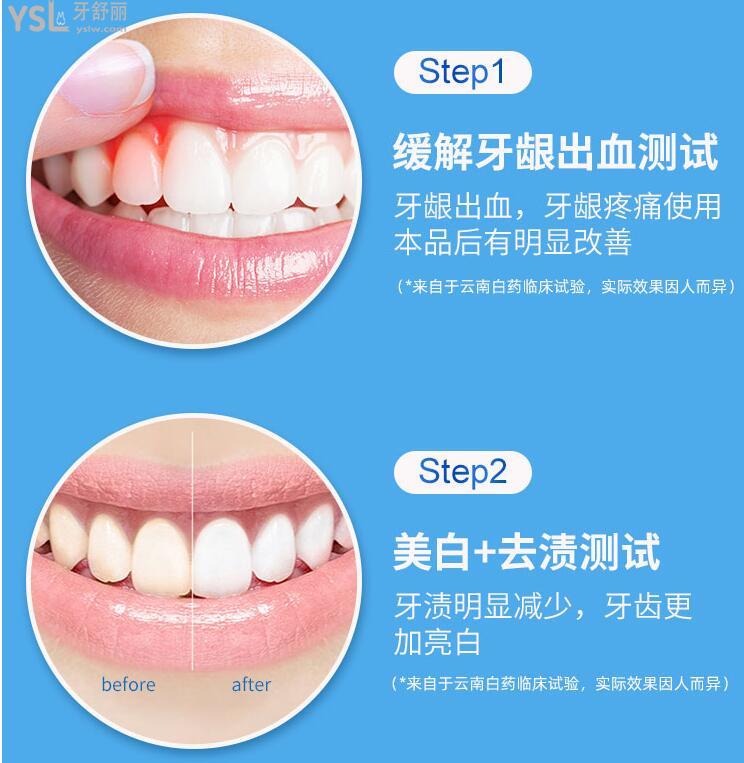 去黃牙膏哪個牌子好 .jpg