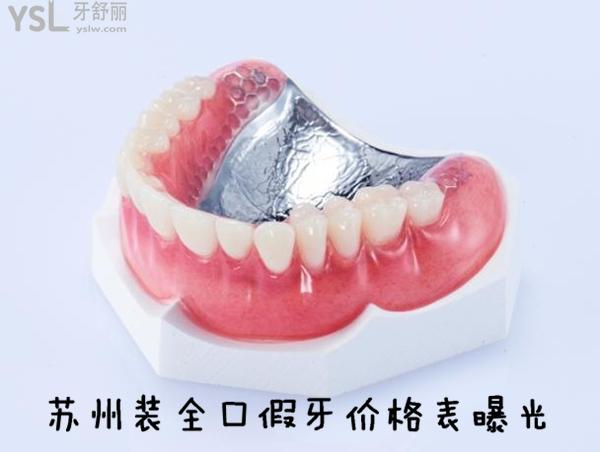 蘇州裝全口假牙價(jià)格表