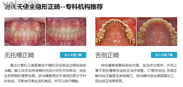 德韓口腔正畸優(yōu)勢(shì)