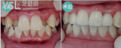 北京西爾口腔醫(yī)院
