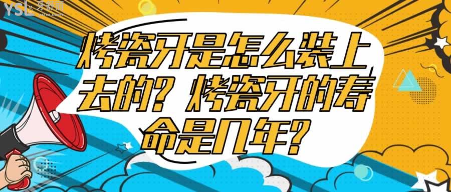烤瓷牙是怎么裝上去的?