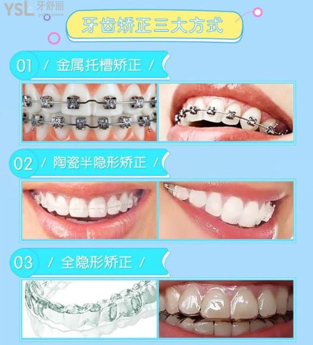 寧波鄞州牙壹家口腔三大矯正方式