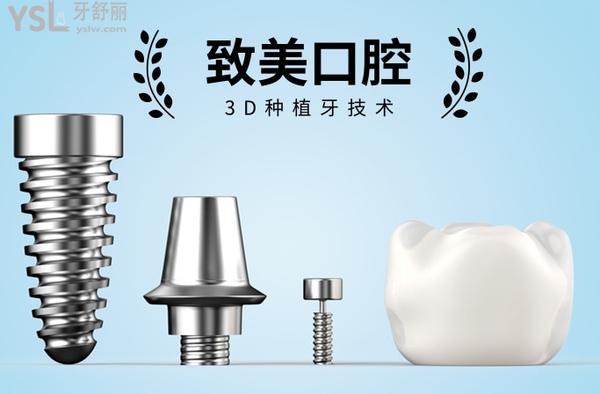 廣州致美口腔醫(yī)院種植牙怎么樣