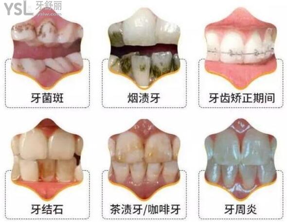 同步齒科為什么便宜 性價(jià)比這么高可以用**嗎.jpg