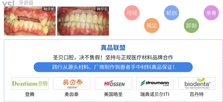 西安種植牙比較好的醫(yī)院