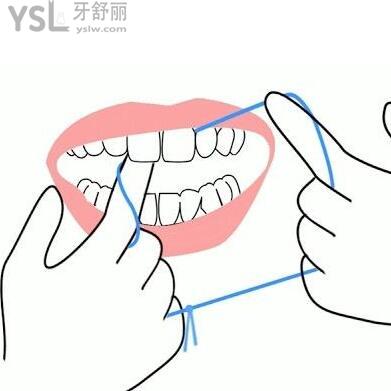 牙線