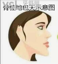 骨性地包天不做手術(shù)可以矯正嗎
