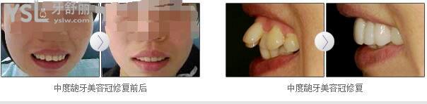 廣州前十家口腔醫(yī)院排名