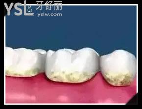 口腔醫(yī)生教你正確使用牙線棒,學(xué)起來(lái).jpg
