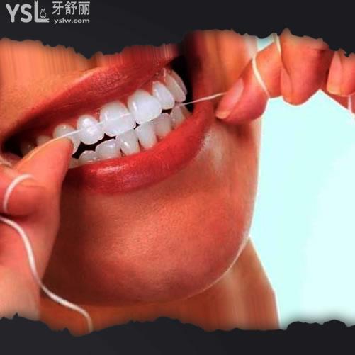 口腔醫(yī)生教你正確使用牙線棒,學(xué)起來(lái).jpg