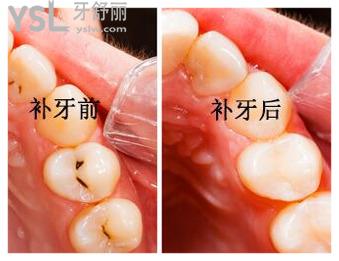 渭南德?tīng)柮揽涂谇辉趺礃?.jpg